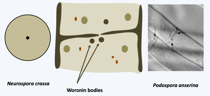 Figure 148.woronin