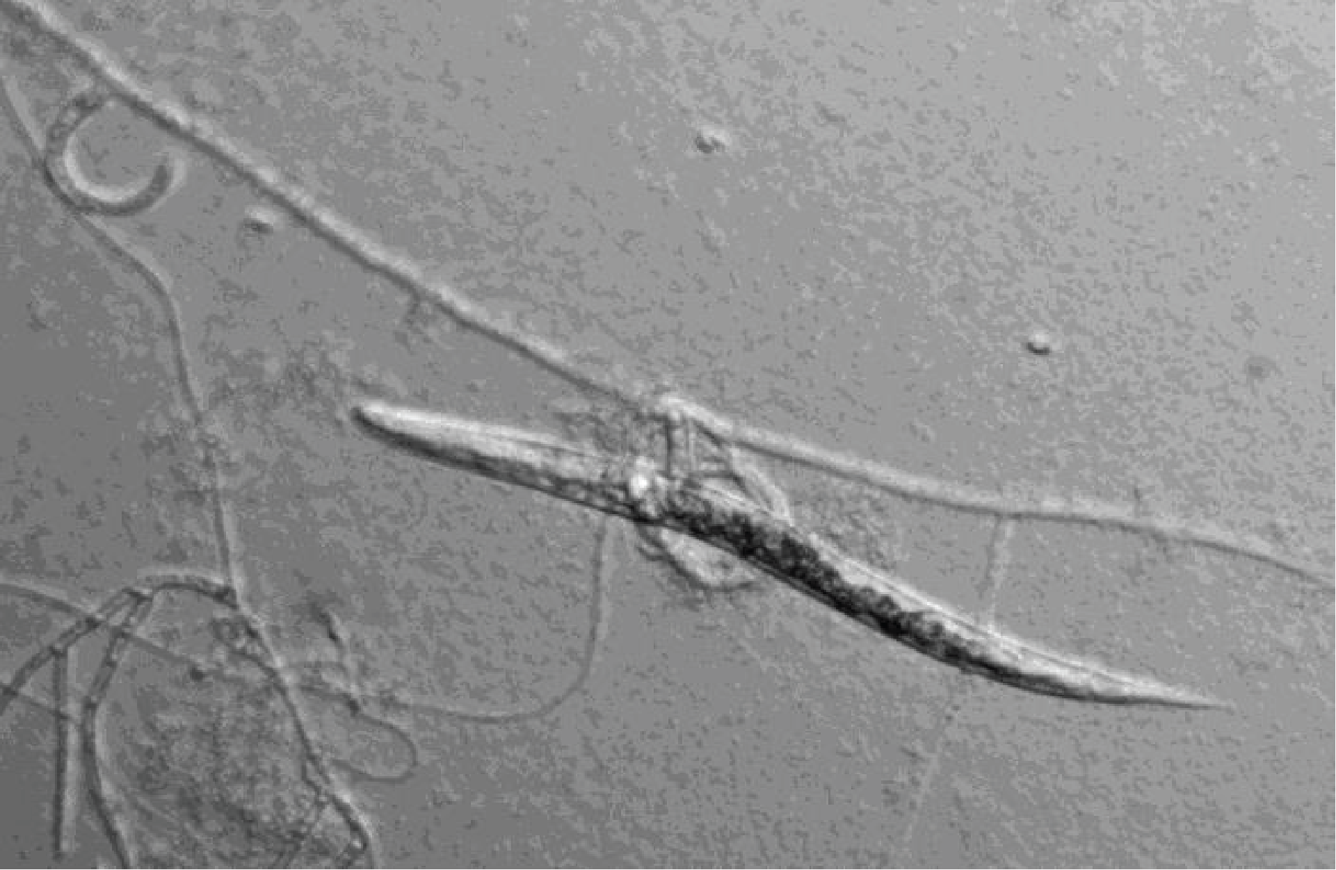 Figure 151.nematode