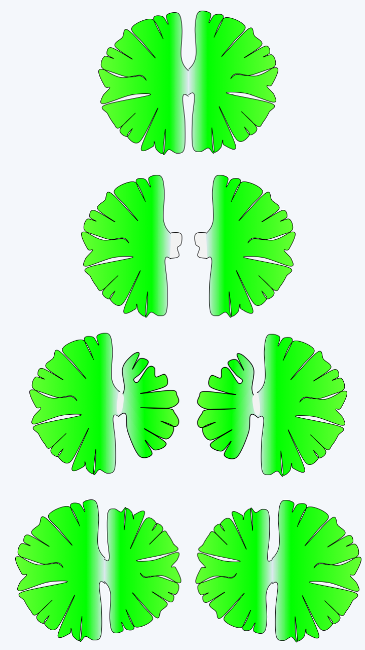 Figure 242.micrasterias